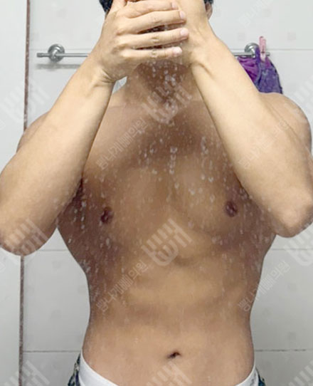 MaleAbdomen2- 후