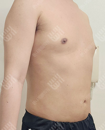 MaleAbdomen3 후