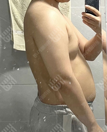 MaleAbdomen4 전