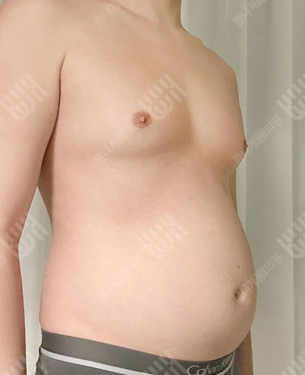 Male Abdomen 전
