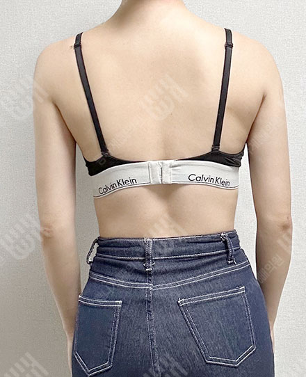 BackLiposuction6 후