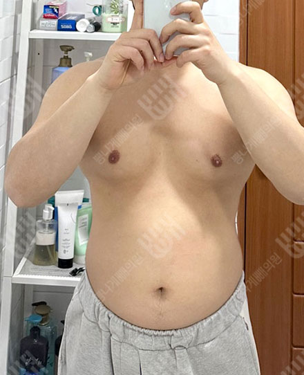 MaleAbdomen2- 전