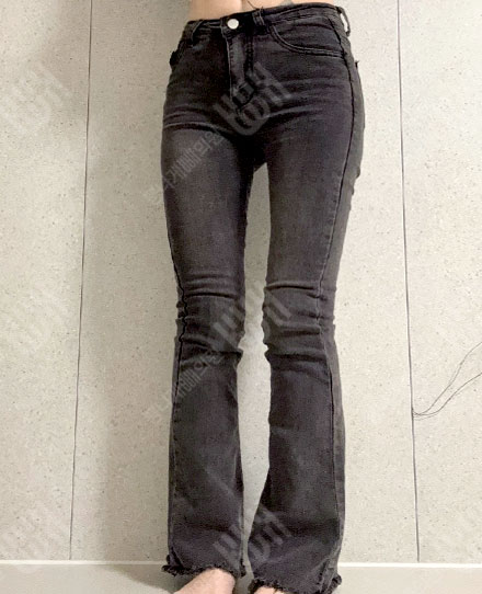 ThighsLiposuction2 후