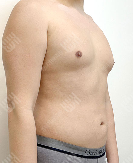 Male Abdomen 후