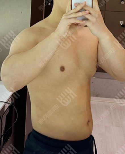 MaleAbdomen4 후