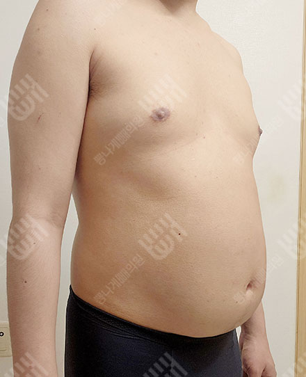 MaleAbdomen3 전