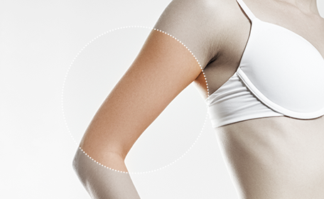 Arm liposuction Arm img