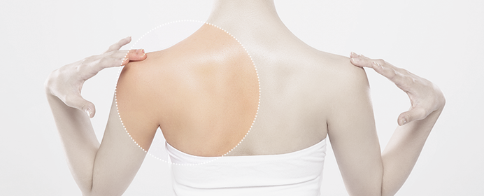 Arm liposuction arm image