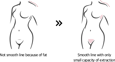 Not smooth line because of fat >> smooth line with only small capacity of extraction