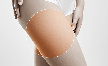 Thigh img