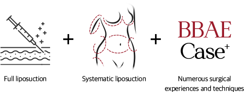 Full liposuction + systematic liposuction + numerous surgical experiences and techniques`
