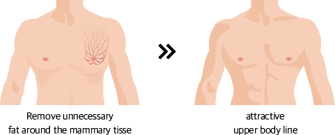 Remove unnecessary Fat around the mammary tisse >> attractive upper body line