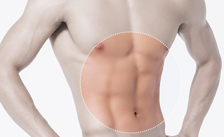 Abdomen Liposuction upper/lower abdomen 