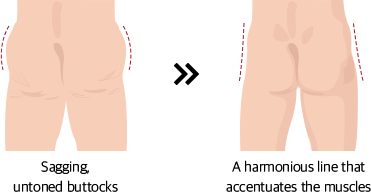 a slender calf line + correction of a curved shape + consideration of the overall angular beauty